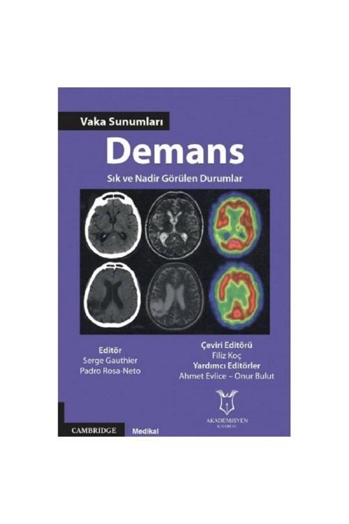 Akademisyen Yayınevi Demans Vaka Sunumları Sık Ve Nadir Görülen Durumlar