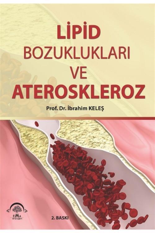 Jbc Yayıncılık Lipid Bozuklukları Ve Ateroskleroz - Ibrahim Keleş 9786058469938