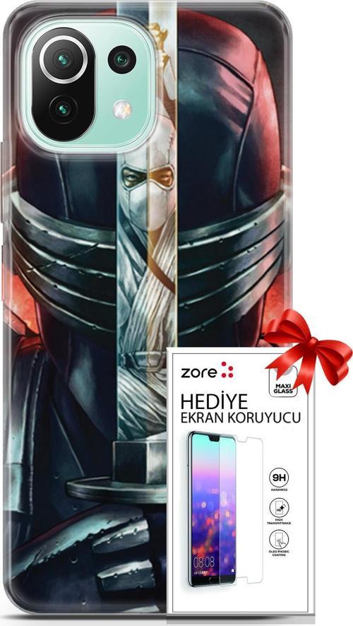 Xiaomi 11 Lite 5G Ne Kılıf Orijinal Seri Supers 08 Snake Eyes Baskılı Kılıf + Ekran Koruyucu