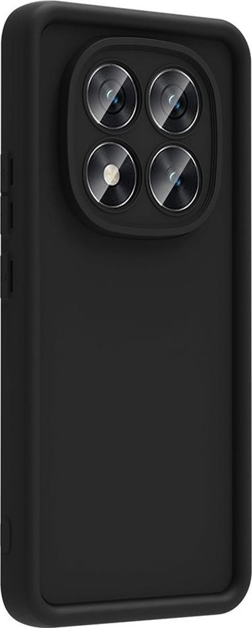 Xiaomi Poco X7 Kılıf Kamera Korumalı Ananas Silikon Kapak