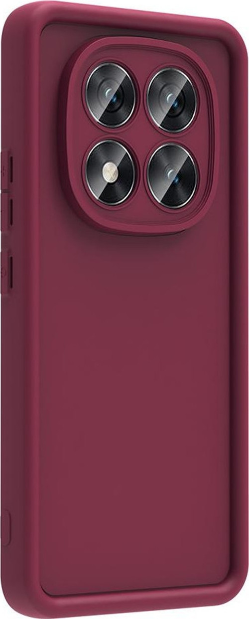 Xiaomi Poco X7 Kılıf Kamera Korumalı Ananas Silikon Kapak
