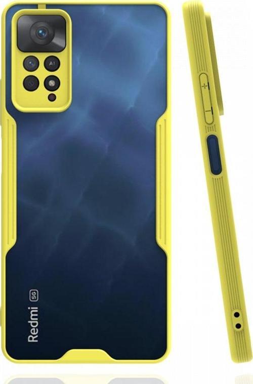Xiaomi Redmi Note 11 Pro Kılıf Platin Silikon