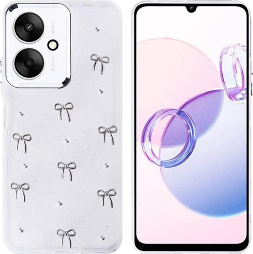 Xiaomi Poco C65 Uyumlu  Kılıf Airbag Tasarımlı Simli Desenli Şeffaf Kutup Kapak