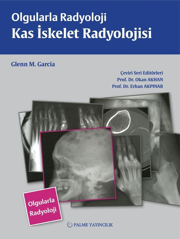 Palme Yayınevi Olgularla Radyoloji Kas İskelet Radyolojisi Kitabı - Palme Yayınları - Image 1