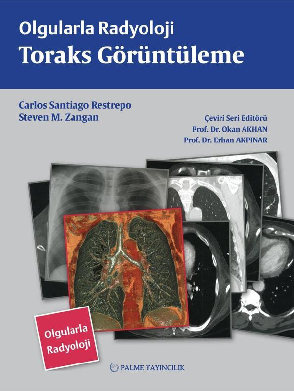 Palme Yayınevi Olgularla Radyoloji Toraks Görüntüleme Kitabı - Palme Yayınları - Image 1