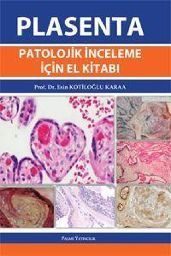 Palme Yayınevi Plasenta Patolojik İnceleme İçin El Kitabı - Palme Yayınları - Image 1