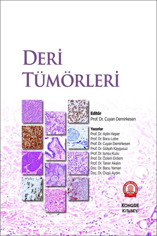 Deri Tümörleri - Ankara Nobel Tıp - Image 1