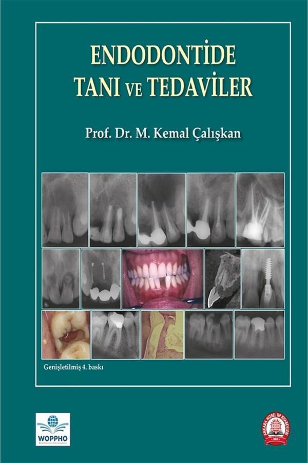 Endodontide Tanı Ve Tedaviler - Ankara Nobel Tıp - Image 1
