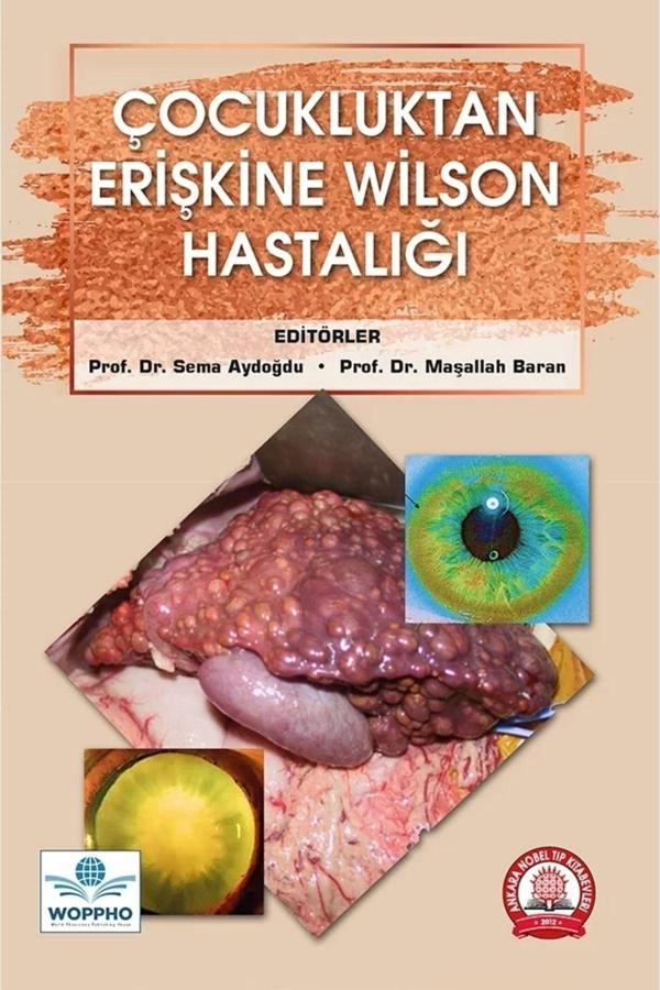 Çocukluktan Erişkine Wilson Hastalığı - Ankara Nobel Tıp - Image 1