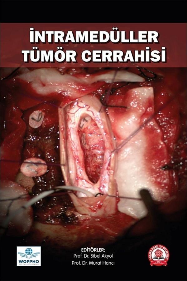 İntramedüller Tümör Cerrahisi - Ankara Nobel Tıp - Image 1