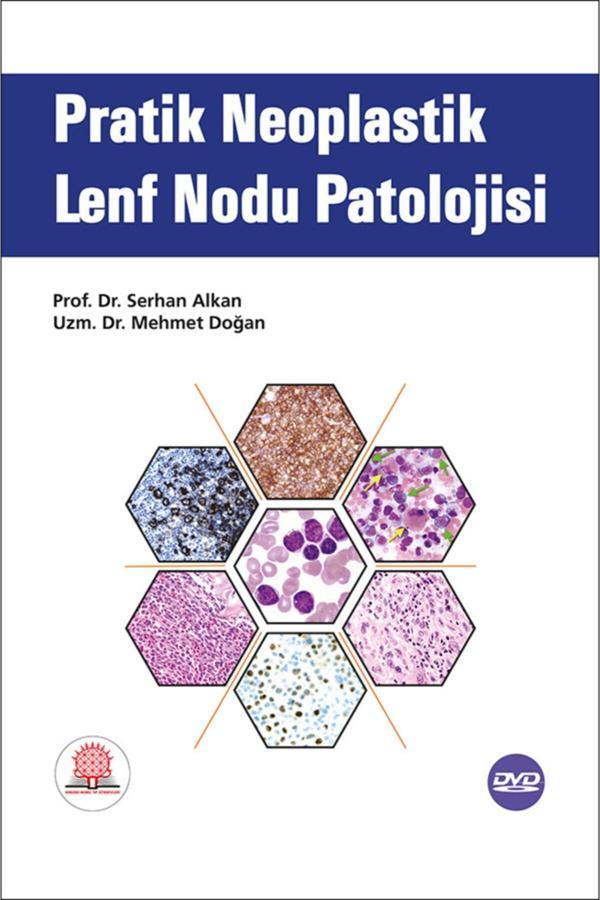 Pratik Neoplastik Lenf Nodu Patolojisi - Ankara Nobel Tıp - Image 1