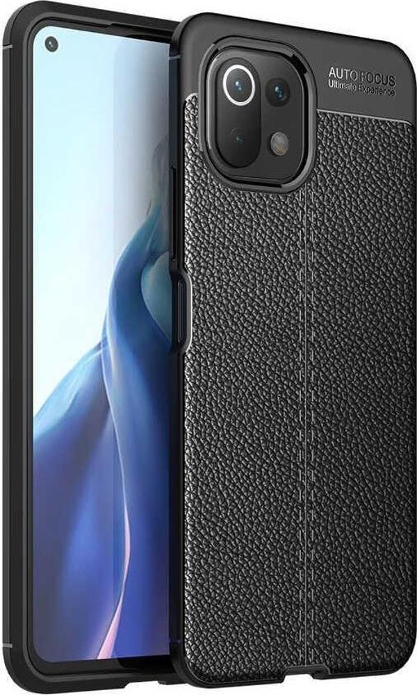 Xiaomi Mi 11 Lite Uyumlu Kamera Korumalı Deri Görünümlü Silikon Kılıf - Image 1