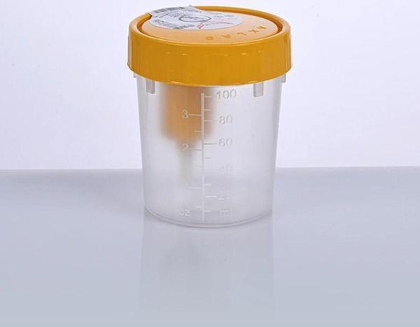 Aklab Group idrar Kabı 100 Ml - 400 Adet Aseptik Steril (Vakumlu Entegre) - Image 1