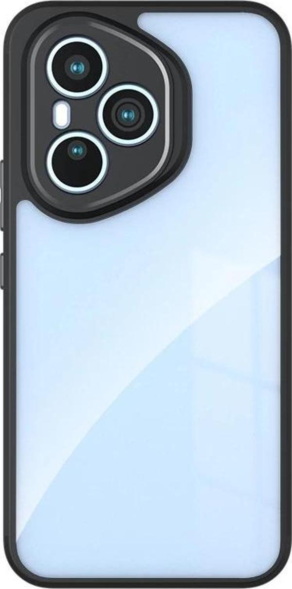 Honor 400 Pro Kılıf Kamera Korumalı Şeffaf Arka Yüzey Zore New Roll Kapak - Image 1