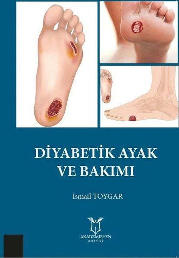 Diyabetik Ayak ve Bakımı - Akademisyen Kitabevi - Image 1