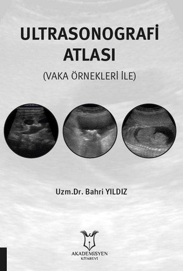 Ultrasonografi Atlası - Vaka Örnekleri İle - Akademisyen Kitabevi - Image 1