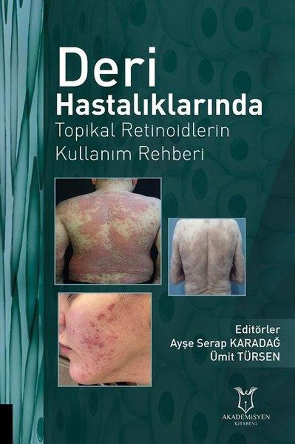 Deri Hastalıklarında Topikal Retinoidlerin Kullanım Rehberi - Akademisyen Kitabevi - Image 1