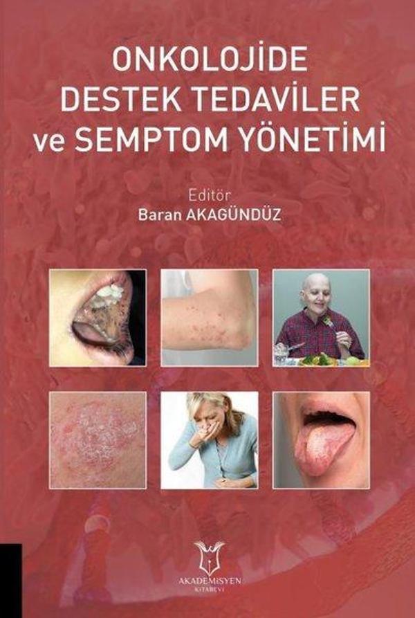 Onkolojide Destek Tedaviler ve Semptom Yönetimi - Akademisyen Kitabevi - Image 1
