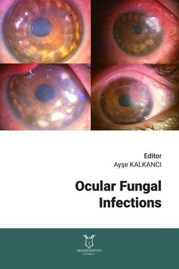 Ocular Fungal Infections - Akademisyen Kitabevi - Image 1