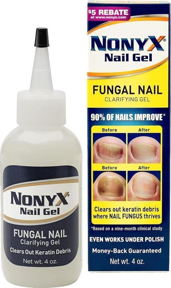 Nonyx Nail Gel 113GR - Image 1