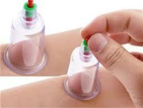 Mor Salkım Home Hacamat Kupası 3 Cm (10 Adet) - Image 1