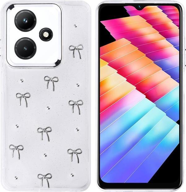 İnfinix Hot 30i Uyumlu Kamera Korumalı Kiraz-Fiyonk Figürlü Silikon Kapak - Image 1