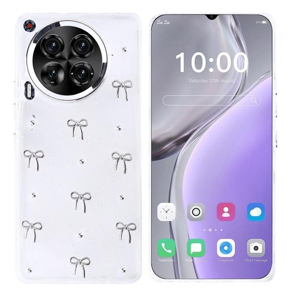 Tecno Camon 30 Uyumlu Kamera Korumalı Kiraz-Fiyonk Figürlü Silikon Kapak - Image 1