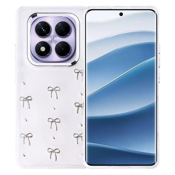 Xiaomi Redmi Note 14 Pro Plus Uyumlu Kamera Korumalı Kiraz-Fiyonk Figürlü Silikon Kapak - Image 1