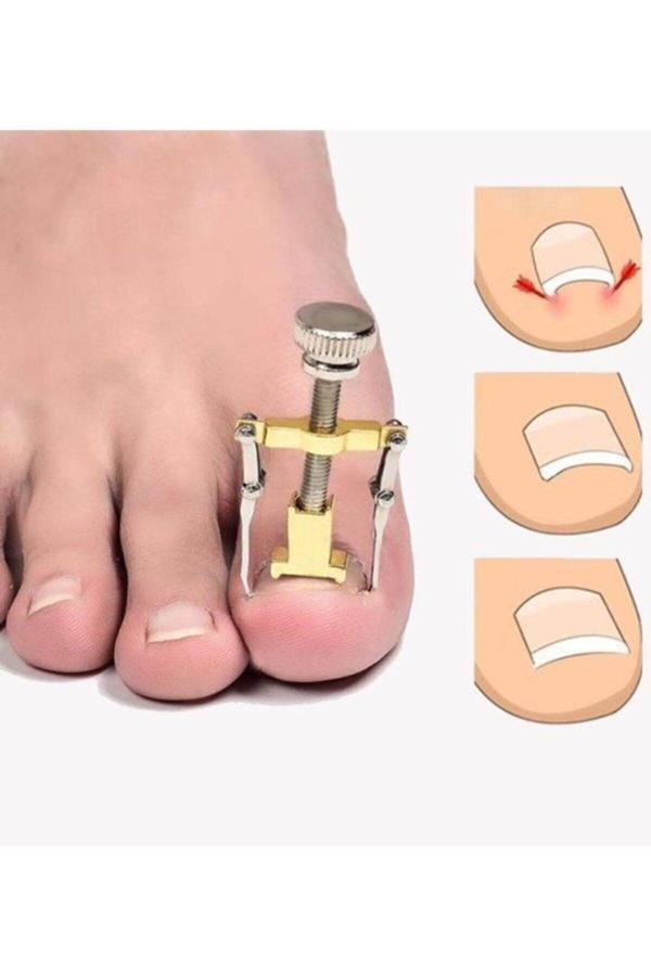 Fix Flex Batık Tırnak Düzeltme Aparatı (Tek)   - Image 1