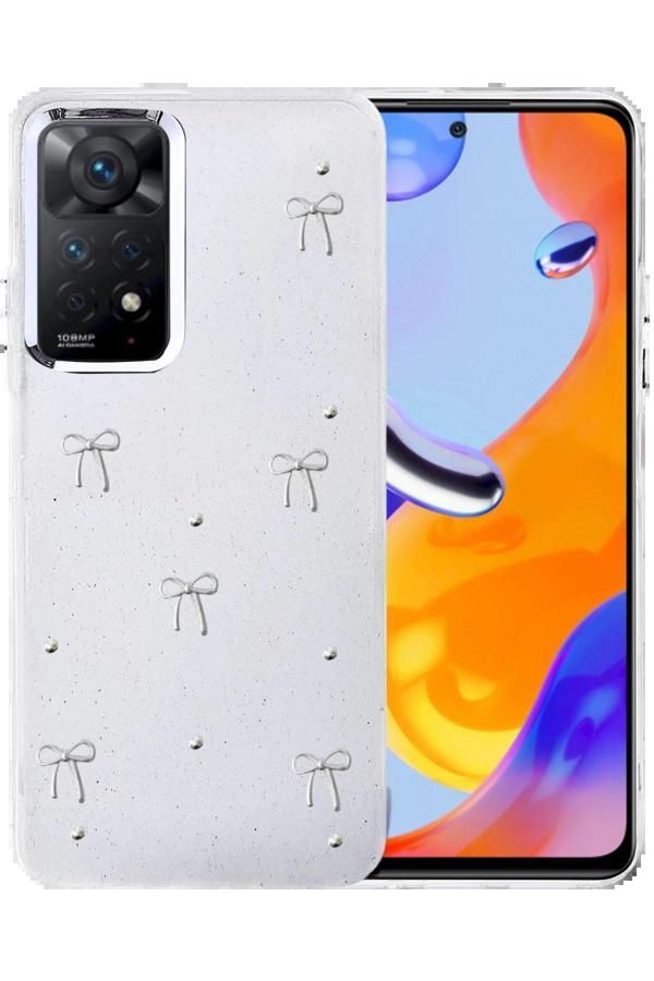 Xiaomi Redmi Note 11 Pro Fiyonk Desenli Kapak - Desen 6-(5796) - Image 1