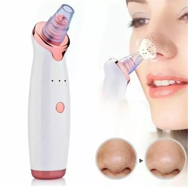 Şarjlı Siyah Nokta Temizleme Cihazı 5 Başlıklı (5060) - Image 1