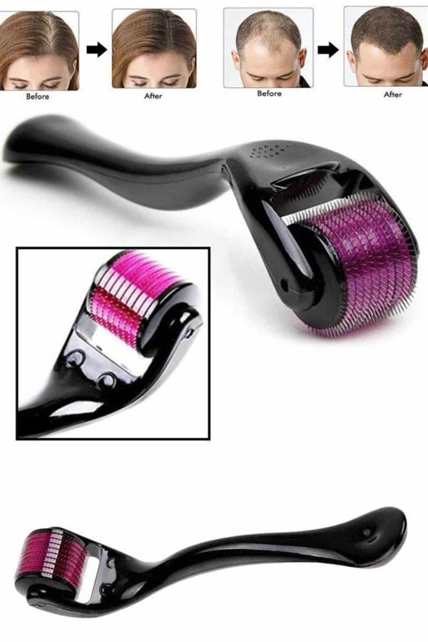 Derma Roller Titanyum Uçlu 540 İğneli 1 Mm Saç Sakal Çıkarma Ve Cilt Bakım Masaj Aleti - Image 1