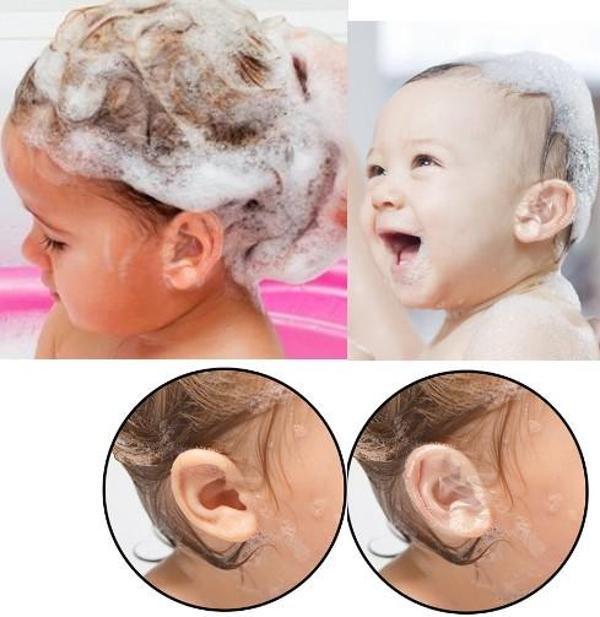 Bebek Banyo Kulak Koruyucu Bant 10 Adet - Image 1