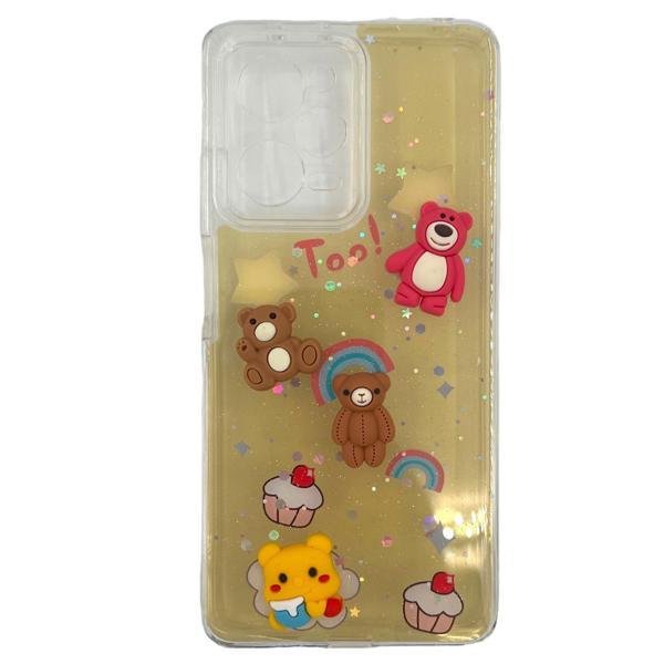 Nettech Xiaomi Redmi Note 12 Pro 5G Uyumlu Mimi Seri Arka Koruma Kılıf NT-107610 - Image 1