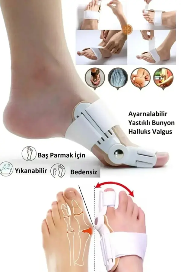 Mucit Home  Atel Ayak Parmak Başparmak Düzeltici Kemik Çıkığı Düzleştirici Taraklı Ayaklar Için Aparat 2'li - Image 1
