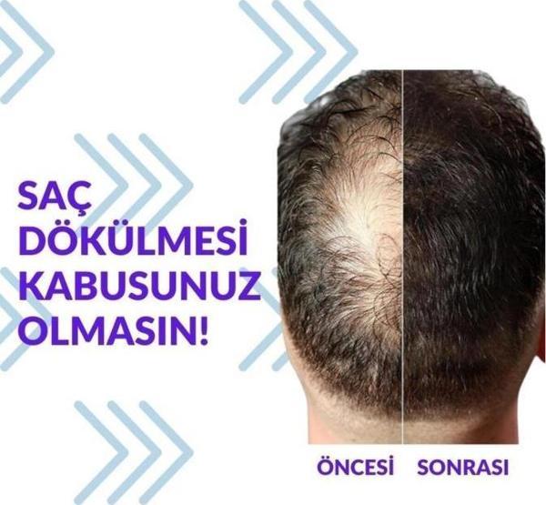 Pak Darou Minioxidil Minoxidil %5 Minoksil Pak Darou - Image 1