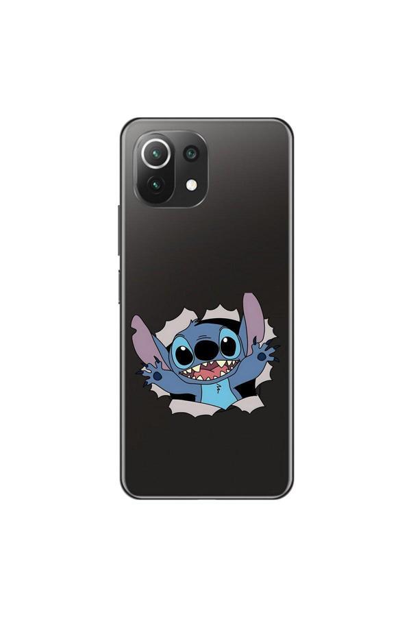 Dali Design Xiaomi Mi 11 Lite Uyumlu Şeffaf Kılıf Couple Stitch 1 Tasarımlı - Image 1