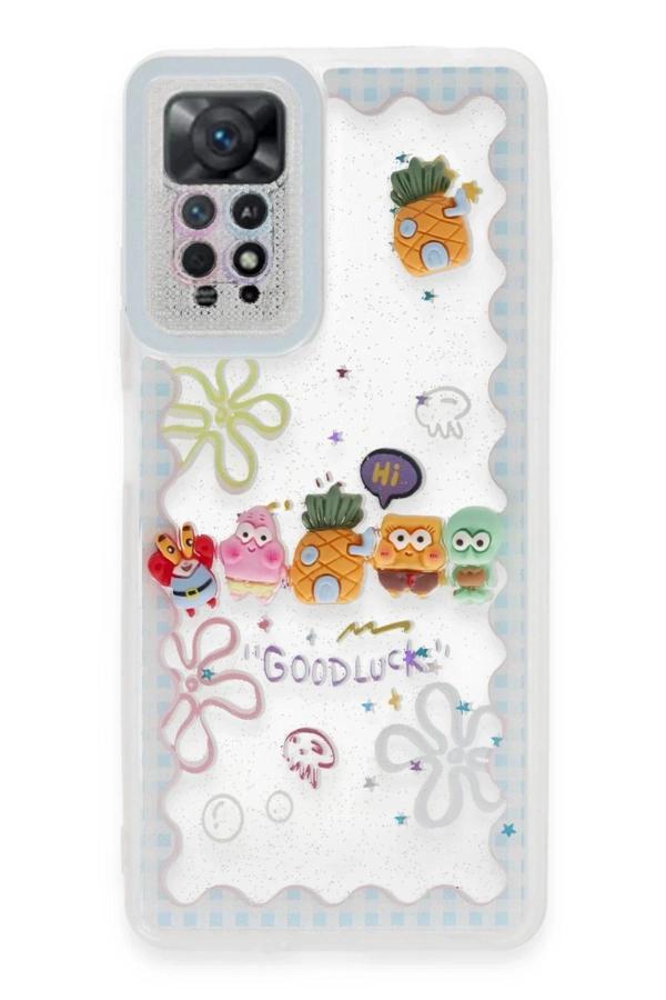 Xiaomi Redmi Note 11 Kılıf Sweet Desenli Silikon Kapak - Açık Mavi-(5796) - Image 1