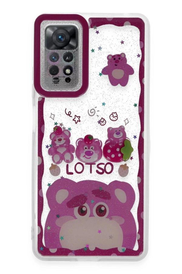 Xiaomi Redmi Note 11 Kılıf Sweet Desenli Silikon Kapak - Pembe-(5796) - Image 1