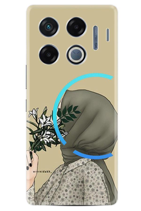 Arvencase İnfinix Gt 20 Pro Kılıf Özel Seri Baskılı Desenli Yüksek Korumalı Xt-312.Jpg - Image 1