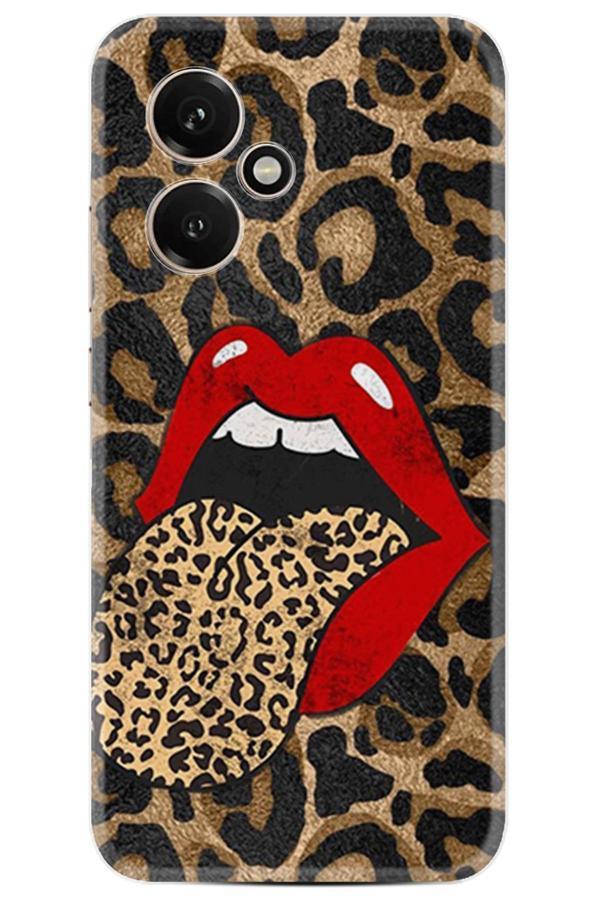 Arvencase Huawei Honor 400 Kılıf Özel Seri Baskılı Desenli Yüksek Korumalı Stk-58.Jpg - Image 1