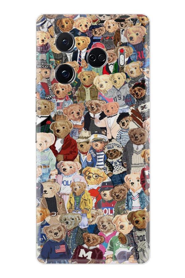 Arvencase Camon 30 Pro 5G Kılıf Dark Seri Tecno-Camon30Pro 2609 Stk-5-30Pro - Image 1