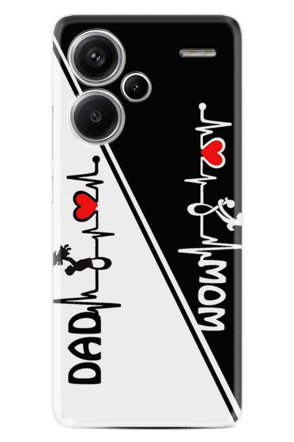 Arvencase Redmi Note 13 Pro Plus 5G Kılıf Baskılı X31-1Xgt Proplus70.Jpg - Image 1