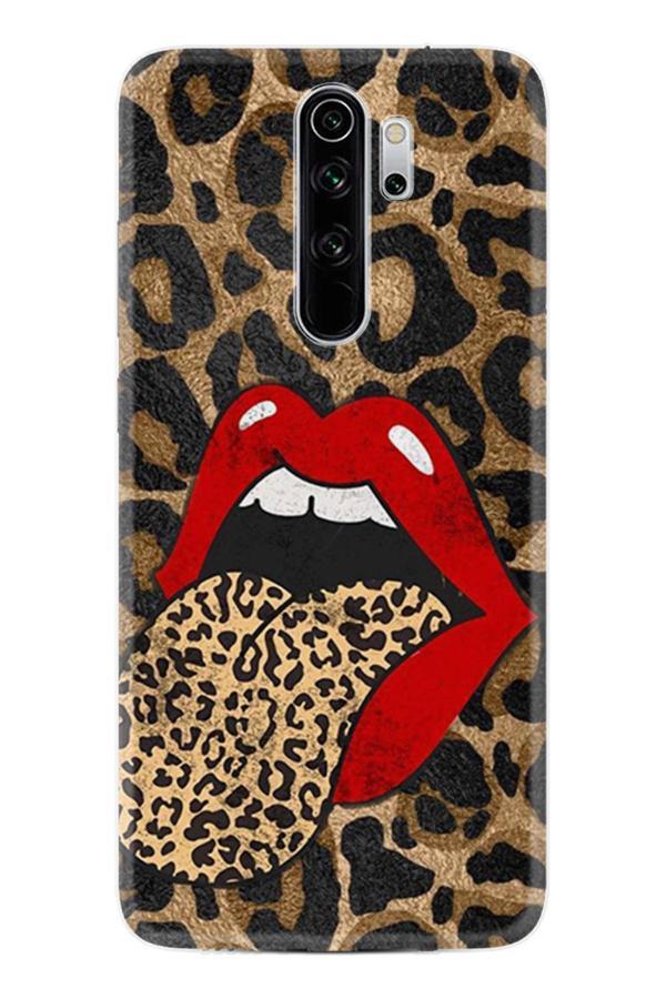 Arvencase Redmi Note 8 Pro Kılıf Kapak Uzun Ömürlü Xı-Ar-8Pro-58Redmix - Image 1