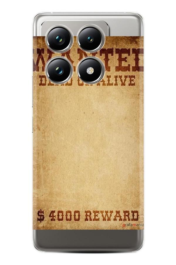 Arvencase Poco X6 Pro Uyumlu Hd Baskılı Kamera Korumalı Desenli Kılıf Poco-Xtgt Name-517-Pocox6Pro - Image 1