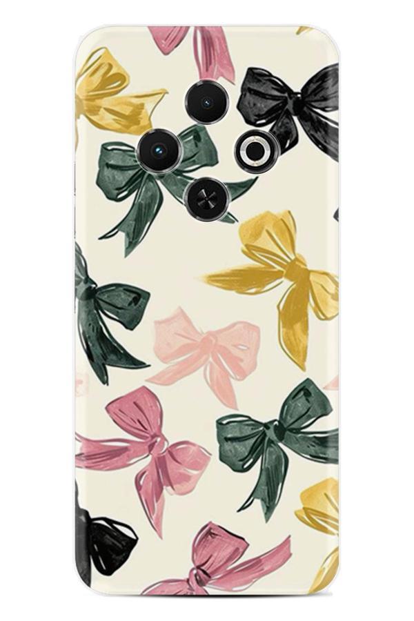 Arvencase Spark 30C Uyumlukılıf Orta Sertlikte Yüksek Korumalı Baskılı Kapak Stk-52-Spark30C - Image 1