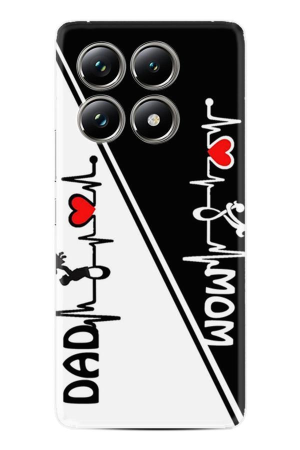 Arvencase Poco X6 Pro Uyumlu Hd Baskılı Kamera Korumalı Desenli Kılıf Poco-Xtgt Name-70-Pocox6Pro - Image 1