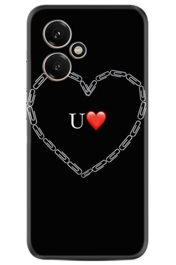 Arvencase Huawei Honor 400 Kılıf Özel Seri Baskılı Desenli Yüksek Korumalı Stk-326.Jpg - Image 1