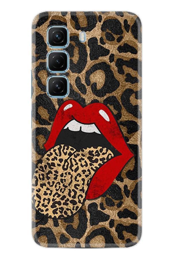 Arvencase Infinix Hot 50 Pro 4G-5G Kılıf Hd Baskılı Kılıf Yüksek Korumalı - Name-58.Jpg - Image 1