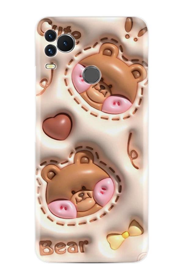 Arvencase Omix X400 Kılıf Hd Baskılı Desenli Paris Seri Xt-Gtomix Stk-529-Omixx400 - Image 1